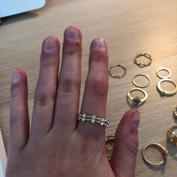 14 Rings - Picture 5 of 10